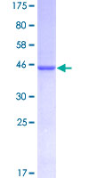 12.5% SDS-PAGE Stained with Coomassie Blue.